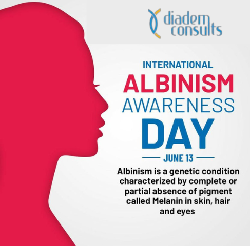 International Albinism Awareness Day is to recognize the human rights of persons with albinism worldwide.
The 2023 theme 'Inclusion is Strength,' has the aim of ensuring the inclusion of their voices in all sectors of life. 

#InclusionIsStrength #InclusiveFuture #AlbinismDay