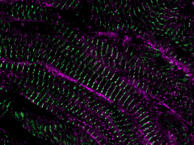 BPoD_s's tweet photo. Replacement Pump – Understanding how #heart #cells mature – steps towards damaged heart repair with lab-grown cells. Image &amp; research by Phong D. Nguyen et al @J_Bakkers lab @_Hubrecht in @ScienceMagazine. Read more on https://t.co/m0EVZ2ZRjv with @MRC_LMS and @rooph https://t.co/38P9ENW0RQ