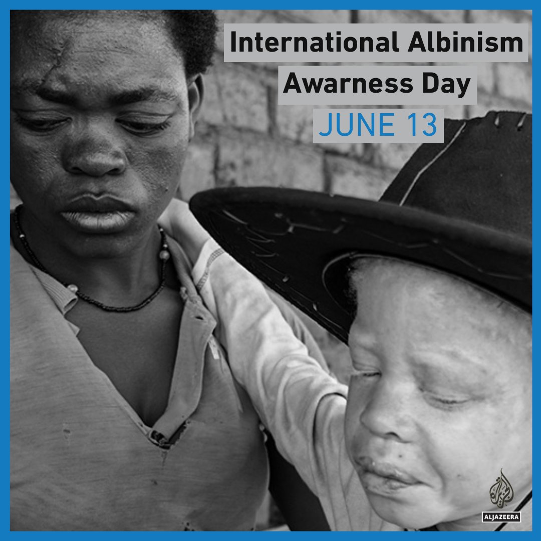 AJEnglish's tweet photo. Thread 🧵

Today is International Albinism Awareness Day, which aims to promote a better understanding of albinism and combat discrimination against people with albinism ⤵️ https://t.co/xBNYtUOX3Q