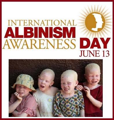 potters_gallery's tweet photo. #WorldAlbinismAwarenessDay #AlbinismAwareness #albinism https://t.co/Rk0ZFgTxOp