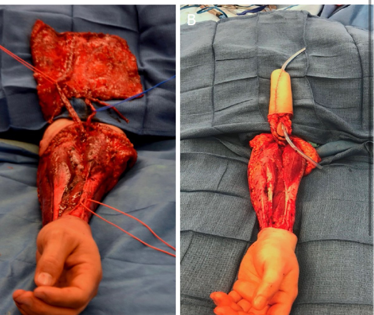 jordanbpeterson's tweet photo. Daring to question the ethical utility of surgery such as this for minors: https://t.co/udJAIF14j4 https://t.co/fKD5rieUGV