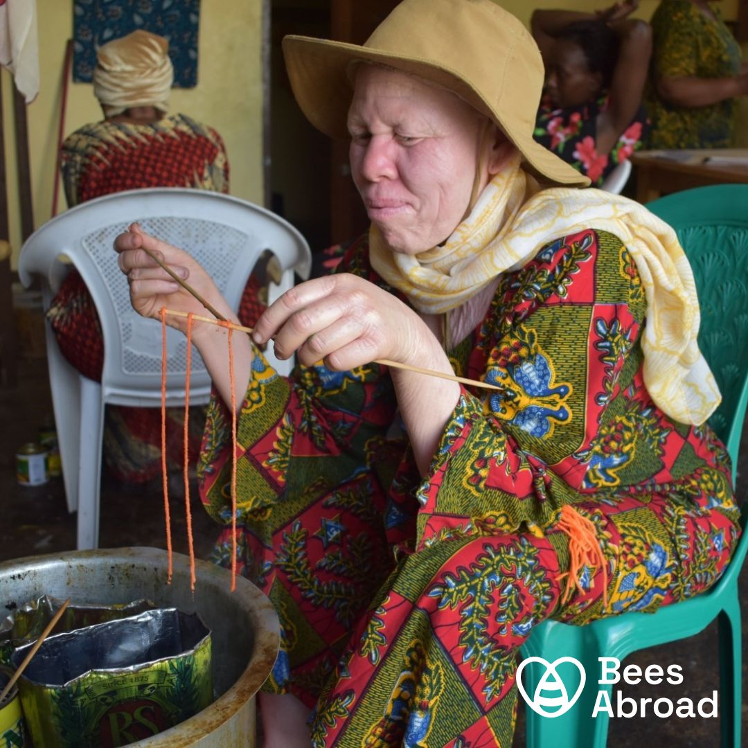 People with albinism are often alienated and stigmatised making it difficult to find work. Bees Abroad works with women like Monica. Monica makes value-added wax products and sells them locally, generating much needed income. #InternationalAlbinismAwarenessDay