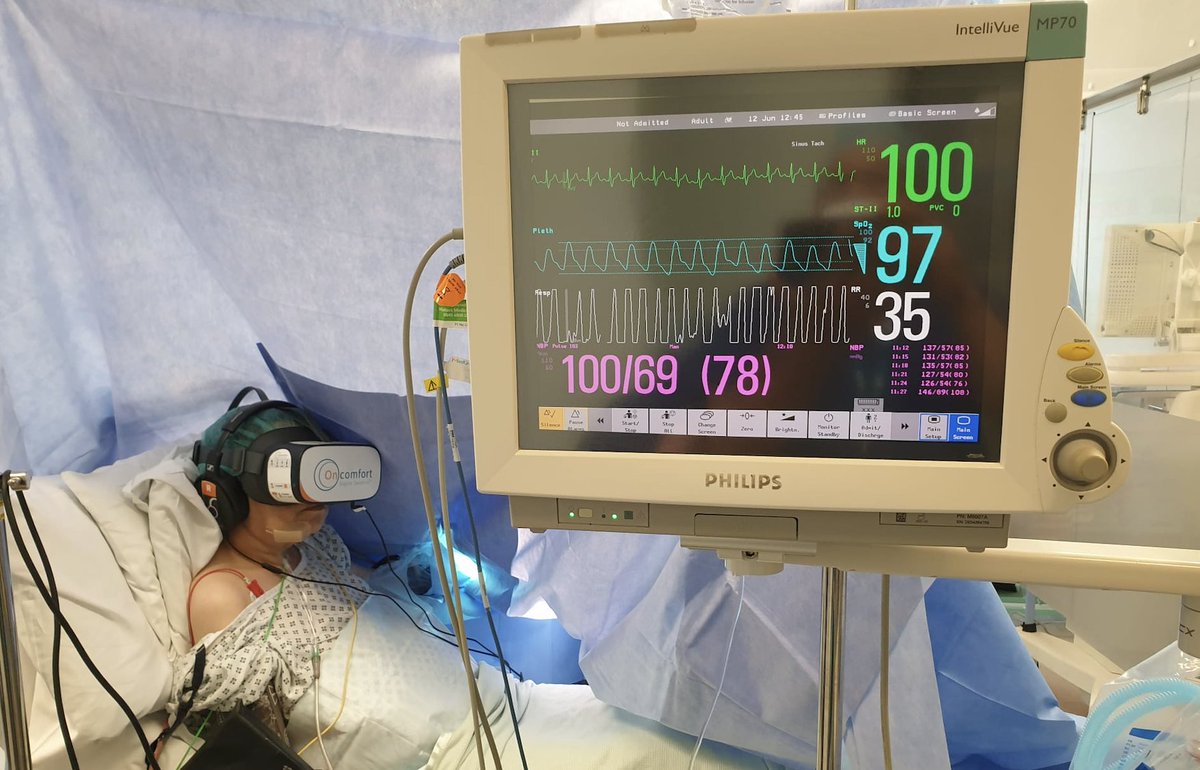 ShivRoyal's tweet photo. #VRSed #USGRA GA IS NOT AN OPTION: Non-Pharmacological Sedation in ASA-IV patient in mid 50s. Pulmonary Hypertension on 24x7 O2, Poor PFTs (Image), Unable to lie down and Difficult Airway (MP-4) Hand Recon Surgery (Darrach's and Tendon Transfer). Done with elbow block and Sedakit https://t.co/mXeVXZDM4H