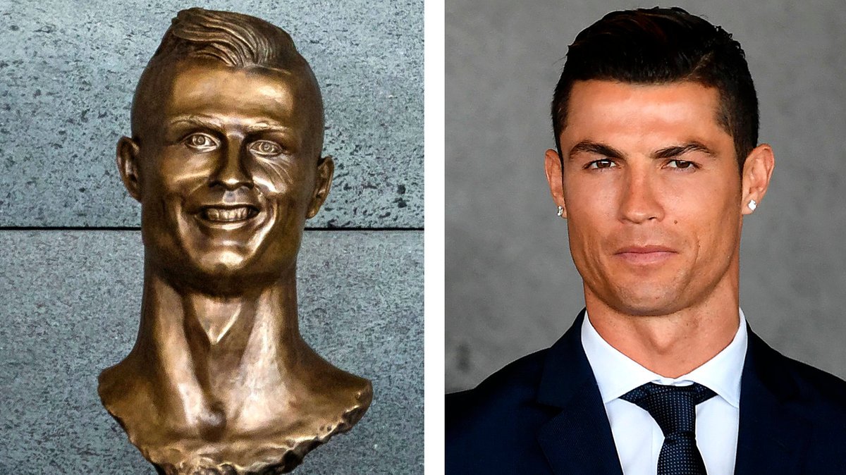 Actual photo of me before and after learning about face wash and moisturizer
