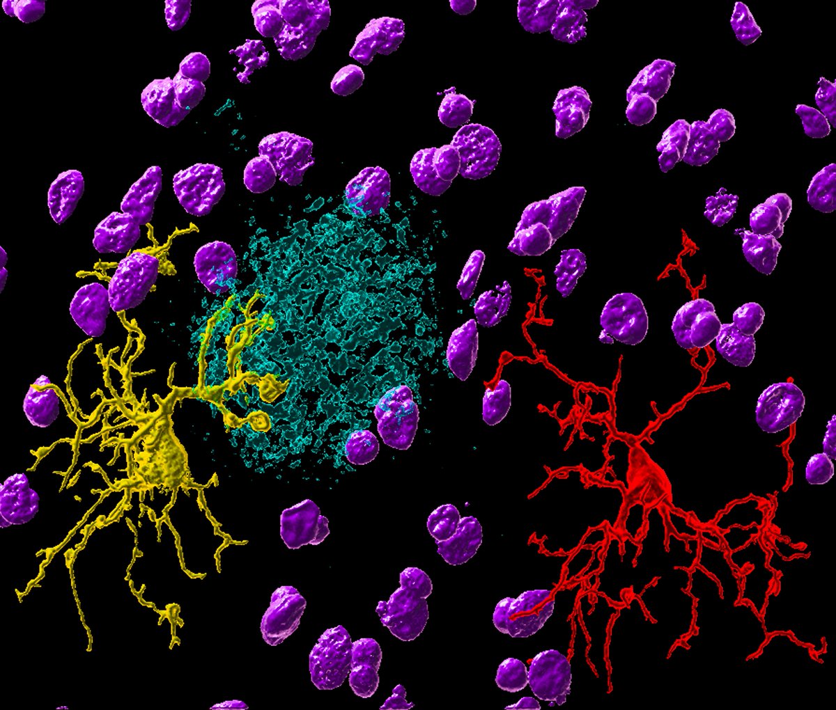 In 3D now 🤓 Microglia cleaning up the mess! #microscopy #neuroscience