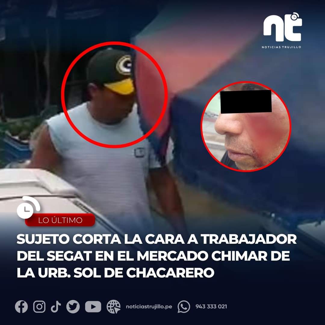ntrujillo_pe's tweet photo. 🔴📌 ¡Lamentable! un vendedor de pescado corta parte del rostro a auxiliar del Segat, Aquiles de La Cruz Argomedo.
✅ Más detalles: https://t.co/0y8QmiM3y0
#NoticiasTrujillo #Trujillo #Segat
🚨Denuncias al 📲 943 333 021 https://t.co/QjC2BNYblV