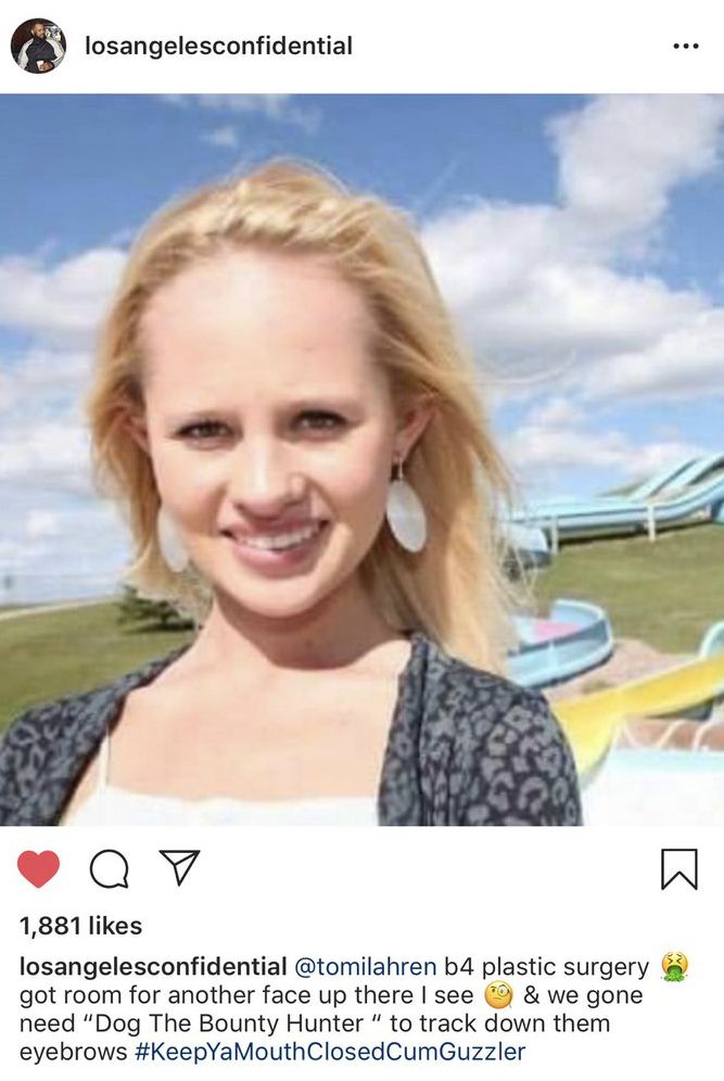 @TomiLahren You've had just as many surgeries as her Tommy.  Quit acting brand new