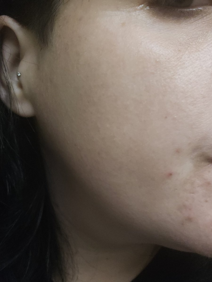 The Lizard Queen 🦎👑 WORLD TAG TEAM CHAMPION 👑 tweet media