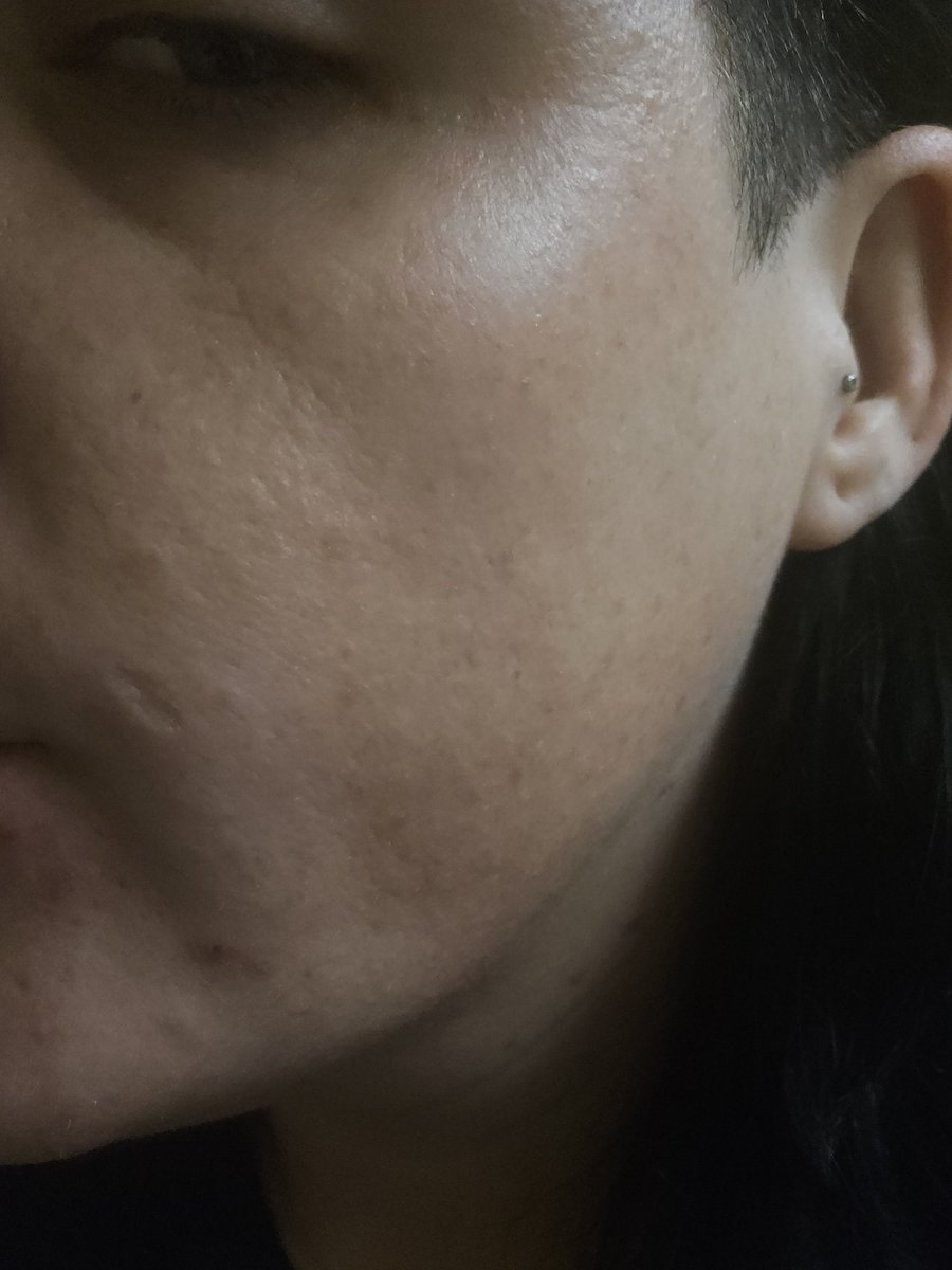 The Lizard Queen 🦎👑 WORLD TAG TEAM CHAMPION 👑 tweet media