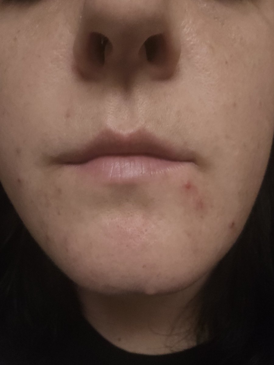 The Lizard Queen 🦎👑 WORLD TAG TEAM CHAMPION 👑 tweet media