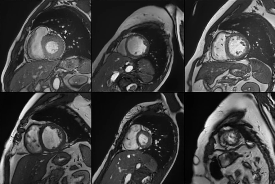 Ruud van Heeswijk tweet media