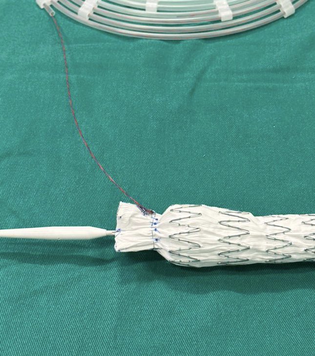 André Brito Queiroz (@andrebrq) on Twitter photo Nice demostration <a href="/Vascupedia_com/">Vascupedia</a> ! We’ve moved to grafts without free flow for similar cases. <a href="/jpcarvalho_vasc/">João Pedro Carvalho, MD</a> <a href="/paulomenezesf/">Paulo Menezes Filho</a> <a href="/fonseca_alan5/">Alan Fonseca</a> Nice demostration <a href="/Vascupedia_com/">Vascupedia</a> ! We’ve moved to grafts without free flow for similar cases. <a href="/jpcarvalho_vasc/">João Pedro Carvalho, MD</a> <a href="/paulomenezesf/">Paulo Menezes Filho</a> <a href="/fonseca_alan5/">Alan Fonseca</a>