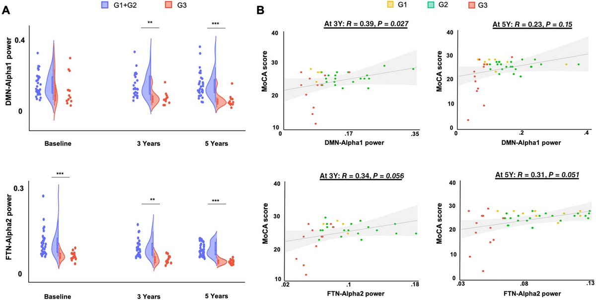 ScienceofPD's tweet image. New report from @sahar__yassine @MahmoodHacan &amp;amp; colleagues identifies #Parkinsons subtypes based on resting-state electroencephalography signatures that may provide a more accurate prognosis in patients &amp;amp; help to stratify subgroups in clinical trials
…mentdisorders.onlinelibrary.wiley.com/doi/10.1002/md…