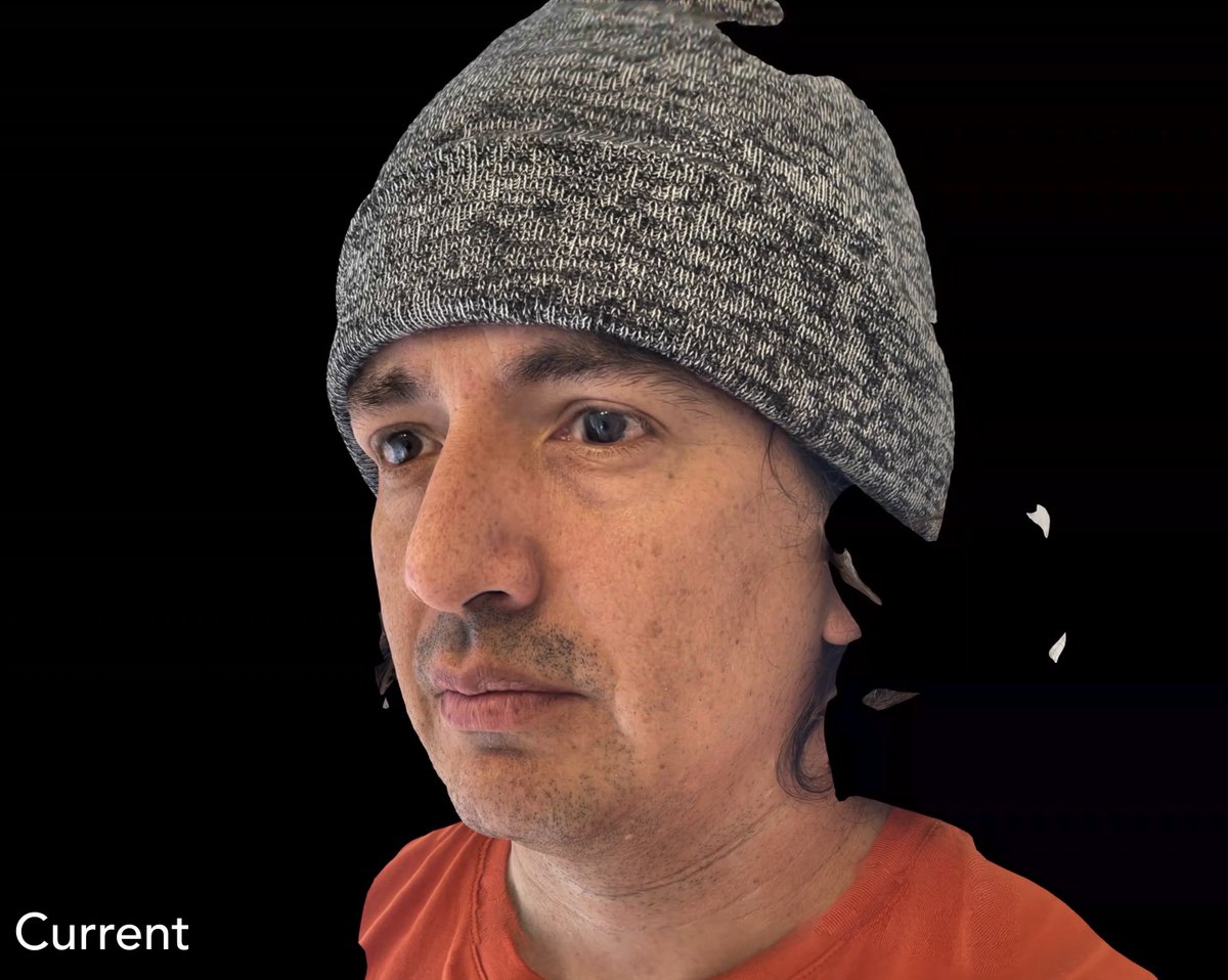 Here’s some results from my 3D selfie comparing our upcoming meshing to the existing Trnio Plus pipeline.  The new geometry has cleaner and more crisp geometries.  Hoping to get this into the app this week!

#trnioplus #photogrammetry #3davatar