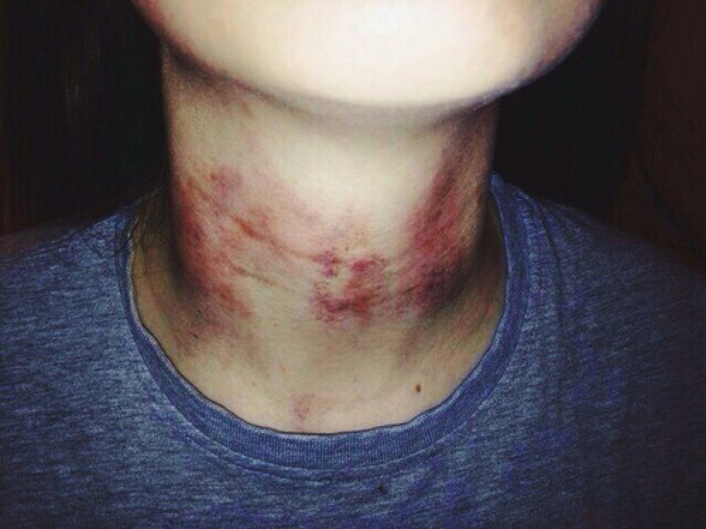 Tenyearoldspide's tweet photo. ㅤ
ㅤ
ㅤㅤㅤㅤYou could be gentler you
ㅤㅤㅤㅤㅤㅤㅤ know. . .
ㅤㅤㅤ
ㅤㅤㅤㅤ https://t.co/lI1be1txne