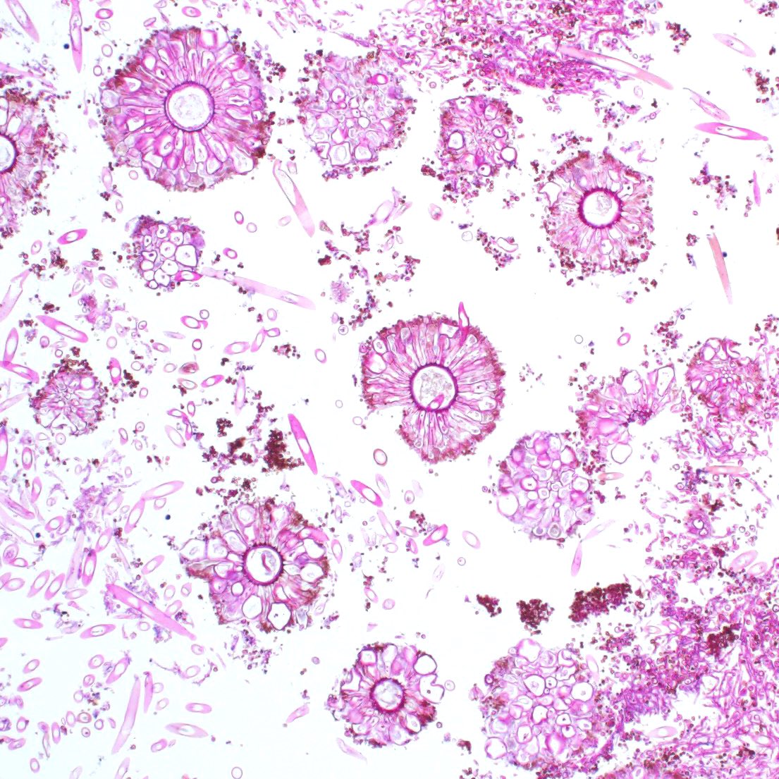 pbult123's tweet photo. Microscopic mushrooms aka fruiting bodies https://t.co/9ktDkvkDsv
