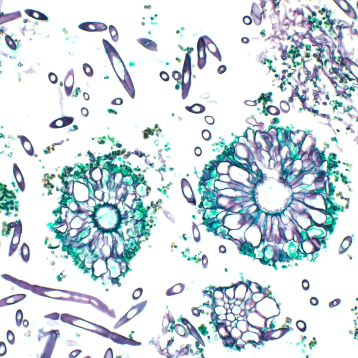 pbult123's tweet photo. Microscopic mushrooms aka fruiting bodies https://t.co/9ktDkvkDsv