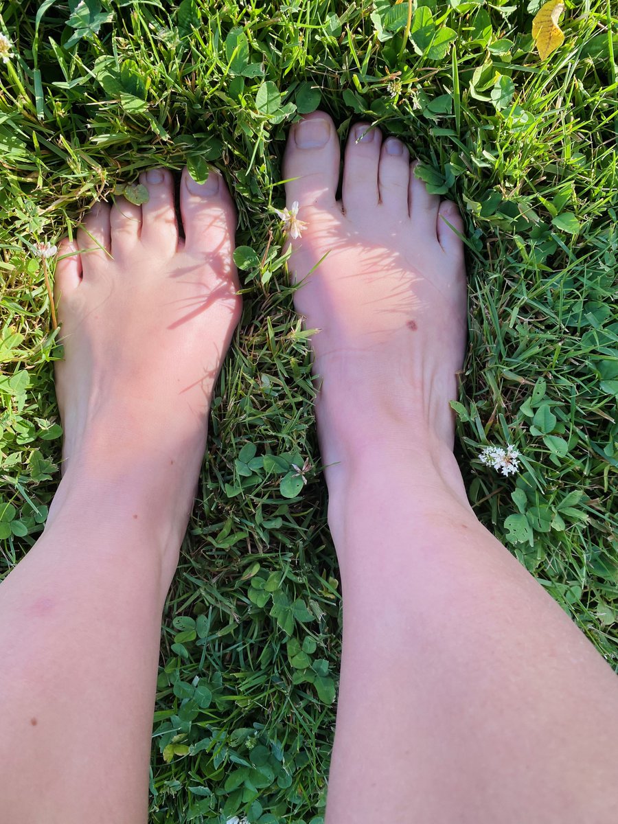 Trippy_afterdrk's tweet photo. Dirty toes in the grass 😋😋

So glad I have a nice yard🤪 I’m barefoot 24/7. 🥰🥰
Think it’s time for a pedicure🙈

#feet_lover #feet_pic #dirtyfeet #feetingrass #nonpaintedtoes #whitefeet #pinksoles #dirtytoes #feetpic #feetfetish #nosocks #arched #feetworship #footpics https://t.co/TdlXVf2JYU