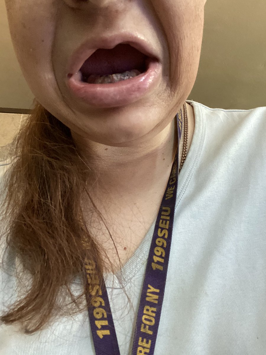 michelednyc's tweet photo. @pulte Daily noti teammate since April2020, please help my live in aide get teeth fixed.She needs a min deposit of $500 for implants for upper &amp; lower plates.Traditional won’t work due to bone loss. She’s suffering , socially&amp; in pain! She still wears mask. Please help $michelednyc https://t.co/pCbS5gbFBN