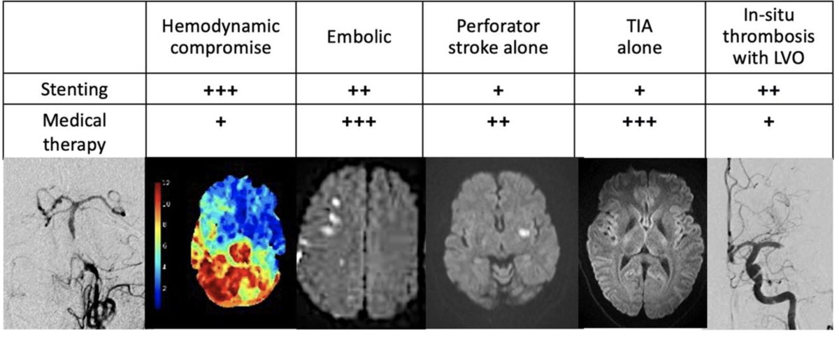 tylcole's tweet photo. This is an excellent and comprehensive review of decision making for ICAD management. 

5x increase over past 6 years of intracranial stenting.

We now have more LVO + stent interventions and better selection criteria than SAMMPRIS.

https://t.co/oBcmbKIhQP

Key figure below: https://t.co/hJ5KTJ4kug