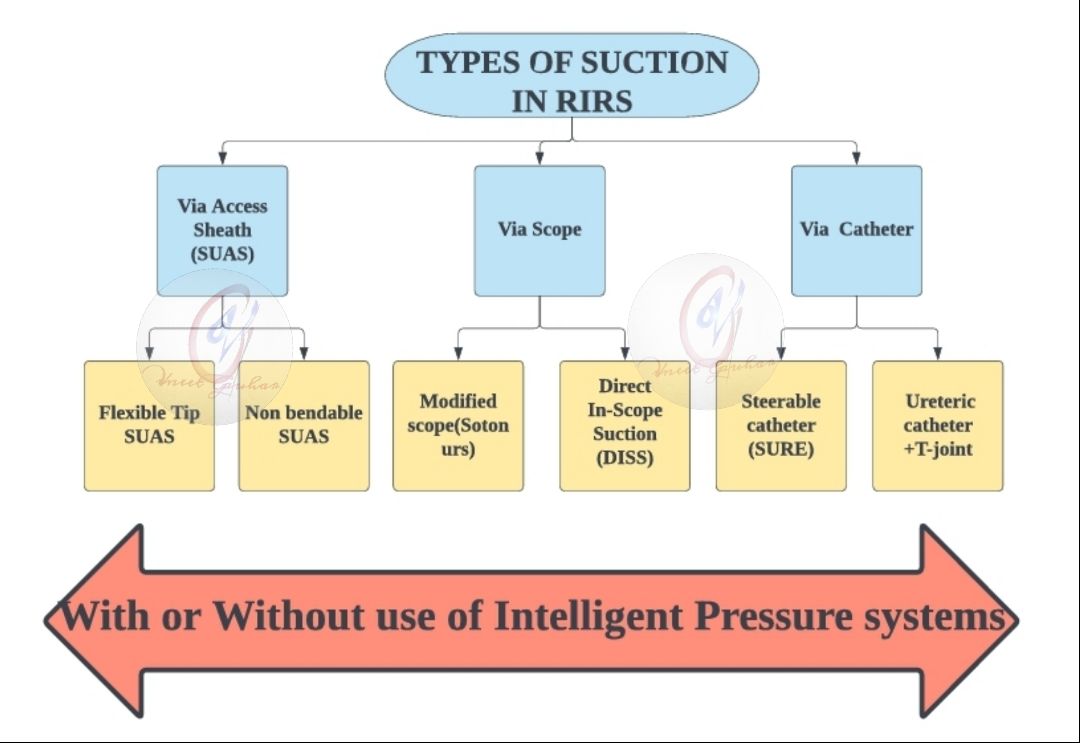 DrG (@docgauhar) on Twitter photo doi.org/10.1016/j.acur…
Diff ways 4 #suction #RIRS❓️
What's good⁉️
🙏 <a href="/emiliani_e/">Esteban Emiliani</a> <a href="/Els_Urology/">Elsevier Urology</a>
<a href="/endouro/">Prof Bhaskar Somani</a> <a href="/GiacomoPirola/">Giacomo Pirola</a> <a href="/GuidoGiusti/">Guido Giusti</a> <a href="/sproietti81/">Silvia Proietti</a> <a href="/VirgilioDS/">Virgilio De Stefano</a> <a href="/Endo_Society/">Endourological Society</a>
<a href="/D_Castellani/">Daniele Castellani</a> <a href="/OTRAXER/">Olivier Traxer</a>
#UroSoMe <a href="/carlo_g/">Carlo G</a> <a href="/PEARLSendouro/">PEARLS</a> <a href="/rodrigodasilva/">Rodrigo da Silva</a>
<a href="/PusenMedical/">Pusen Medical</a> <a href="/Bioradmed_India/">Biorad Medisys Pvt. Ltd.</a> doi.org/10.1016/j.acur…
Diff ways 4 #suction #RIRS❓️
What's good⁉️
🙏 <a href="/emiliani_e/">Esteban Emiliani</a> <a href="/Els_Urology/">Elsevier Urology</a>
<a href="/endouro/">Prof Bhaskar Somani</a> <a href="/GiacomoPirola/">Giacomo Pirola</a> <a href="/GuidoGiusti/">Guido Giusti</a> <a href="/sproietti81/">Silvia Proietti</a> <a href="/VirgilioDS/">Virgilio De Stefano</a> <a href="/Endo_Society/">Endourological Society</a>
<a href="/D_Castellani/">Daniele Castellani</a> <a href="/OTRAXER/">Olivier Traxer</a>
#UroSoMe <a href="/carlo_g/">Carlo G</a> <a href="/PEARLSendouro/">PEARLS</a> <a href="/rodrigodasilva/">Rodrigo da Silva</a>
<a href="/PusenMedical/">Pusen Medical</a> <a href="/Bioradmed_India/">Biorad Medisys Pvt. Ltd.</a>