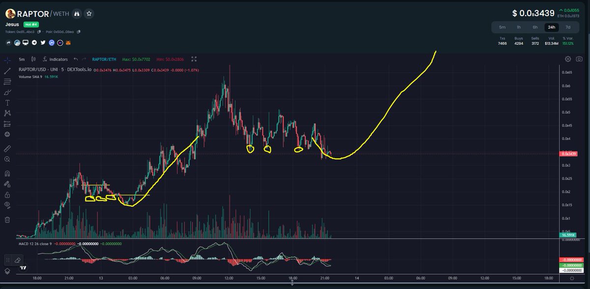 DJZeusman's tweet photo. YESTERDAY I SAID TRIPPLE BOTTOM MEANS BULLISH UPTREND! SO NOW WE HITTING THE SAME TRIPPLE BOTTOM AGAIN SO YOU KNOW WHAT THAT MEANS! ✝️✝️✝️⛪️⛪️��️🚨🚨🚨🔥🔥🔥👀👀👀#raptorjesus #RJ #NEXT100XGEM #ERC20 https://t.co/rFeQ5aoObh