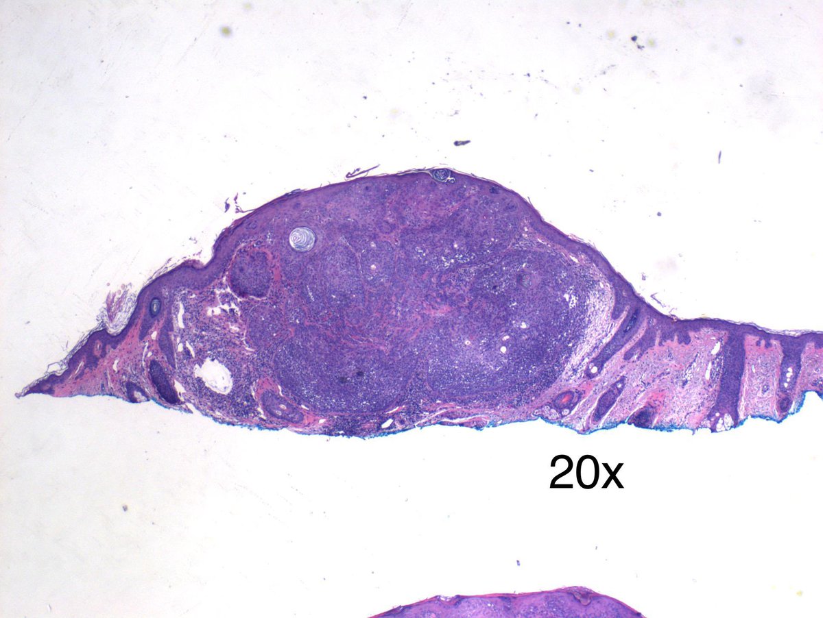 Dermpath_doc_trish tweet media