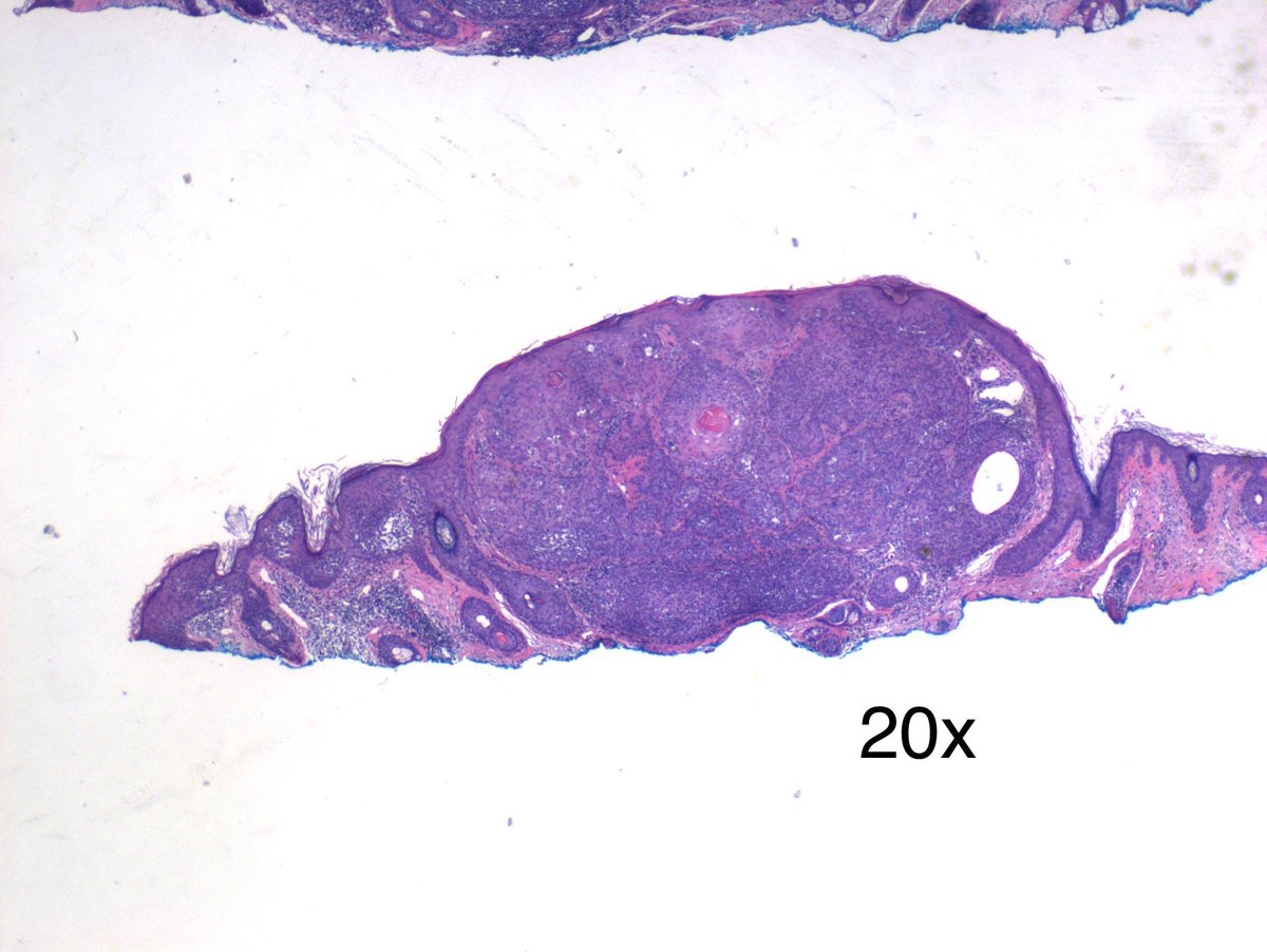 Dermpath_doc_trish tweet media