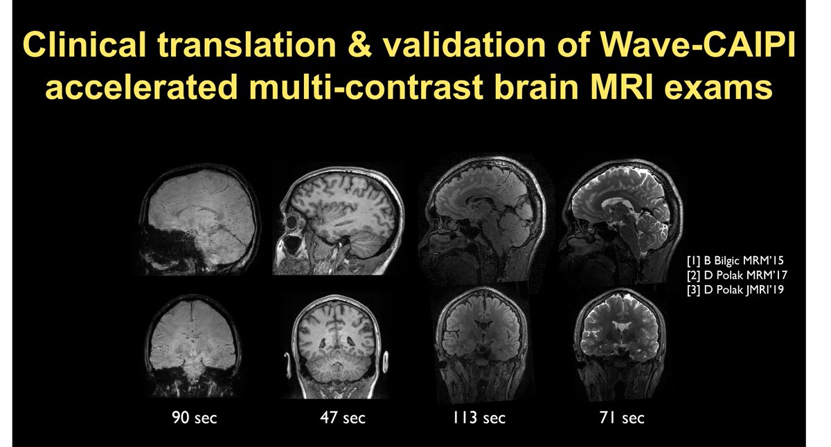 American Society of Functional Neuroradiology (@theasfnr) on Twitter photo <a href="/SusieHuangMDPhD/">Susie Huang</a> will be speaking about Accelerated Imaging at the next ASFNR webinar.
🗓Tuesday, June 20th
🕙10:00AM (U.S. Eastern Time)
📭 Email sent with Zoom link! <a href="/SusieHuangMDPhD/">Susie Huang</a> will be speaking about Accelerated Imaging at the next ASFNR webinar.
🗓Tuesday, June 20th
🕙10:00AM (U.S. Eastern Time)
📭 Email sent with Zoom link!