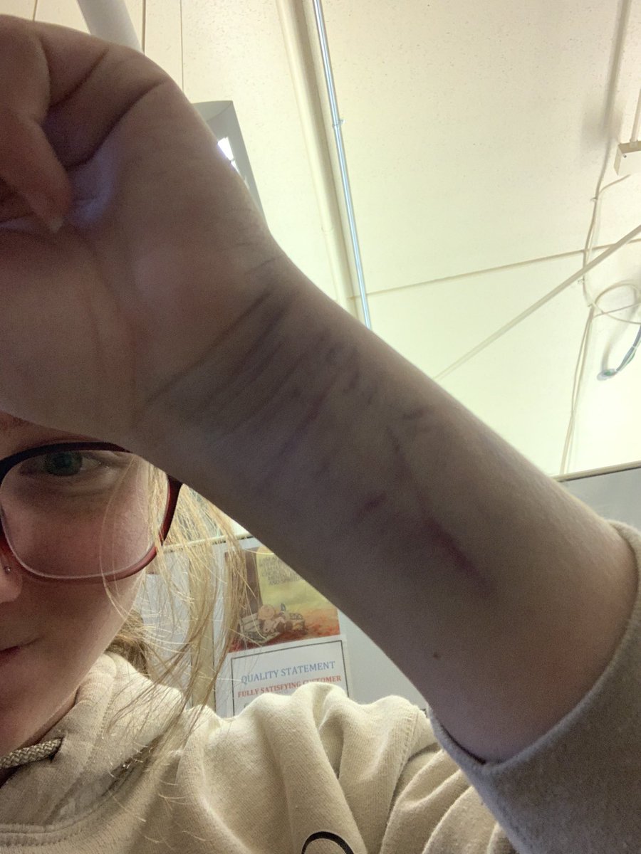 RubyMcConnell20's tweet photo. This weekend I took a pitch to the wrist while batting. After just a few minutes my forearm was double the size it should’ve been and my wrist is bruised the entire way around. We went for x-rays and i’m very happy to say that I have no breaks or fractures and am able to play! https://t.co/sYLyfhU5aV