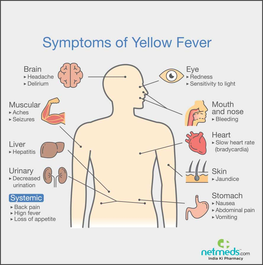 BorneWater's tweet photo. #llness ranges from a #fever with #aches and pains to #severe liver #disease with #bleeding and #yellowing skin (jaundice). #Yellow fever infection is #diagnosed based on laboratory testing, a person's #symptoms, and #travel history.
https://t.co/47HS9oFtXO https://t.co/xYLlnAfA4V