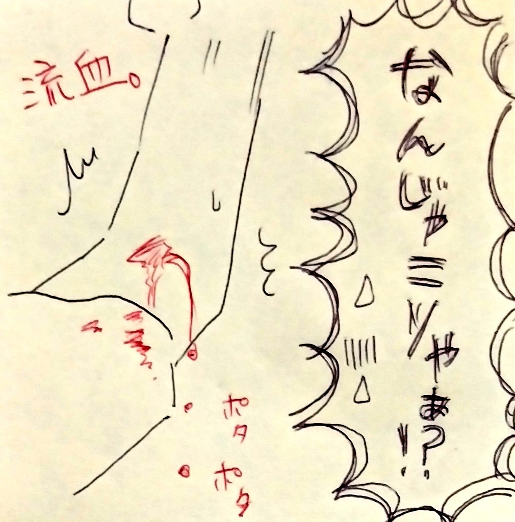 仕事中に左腕が血まみれになっててビックリした話。点滴は体調不良でなく美容系のもの。体調不良ではございませんのでご心配なく(^^)🎵

#漫画が読めるハッシュタグ 
#漫画がよめるハッシュタグ 
#漫画 
#流血 https://t.co/aMxiclu6W3
