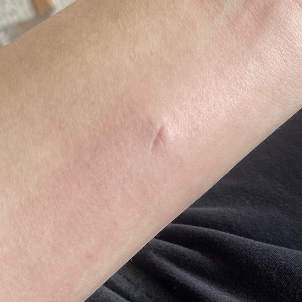 เช็คประชากร เคยทำแบบนี้เวลายุงกัด กดรี