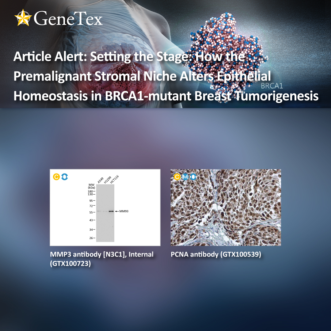 genetexinc's tweet photo. It is now generally accepted that the notion of malignancy extends beyond the genetic and/or epigenetic changes that create a cancerous cell. A rapidly expanding body of...
🔗https://t.co/V7uZug7s6B
#BRCA1
#MMP3
#Cytokeratin
#stromalniche
#cancerassiciatedfibroblast
#stromacell https://t.co/VHXOvQgfxF
