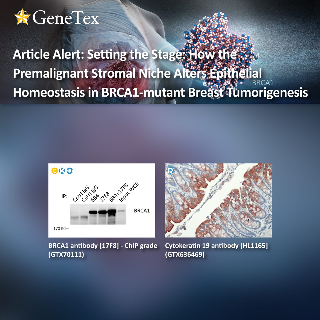 genetexinc's tweet photo. It is now generally accepted that the notion of malignancy extends beyond the genetic and/or epigenetic changes that create a cancerous cell. A rapidly expanding body of...
🔗https://t.co/V7uZug7s6B
#BRCA1
#MMP3
#Cytokeratin
#stromalniche
#cancerassiciatedfibroblast
#stromacell https://t.co/VHXOvQgfxF