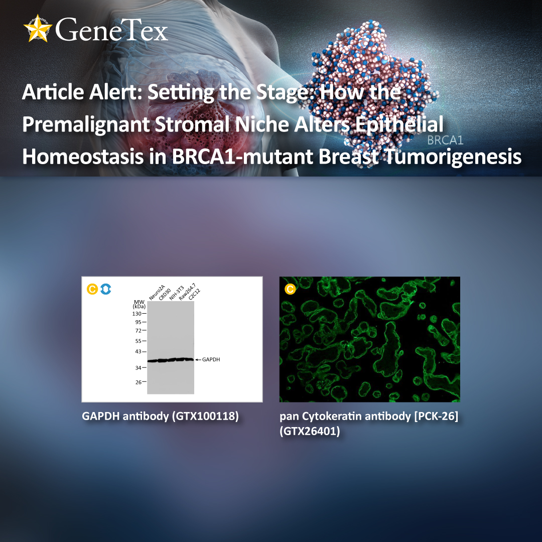 genetexinc's tweet photo. It is now generally accepted that the notion of malignancy extends beyond the genetic and/or epigenetic changes that create a cancerous cell. A rapidly expanding body of...
🔗https://t.co/V7uZug7s6B
#BRCA1
#MMP3
#Cytokeratin
#stromalniche
#cancerassiciatedfibroblast
#stromacell https://t.co/VHXOvQgfxF