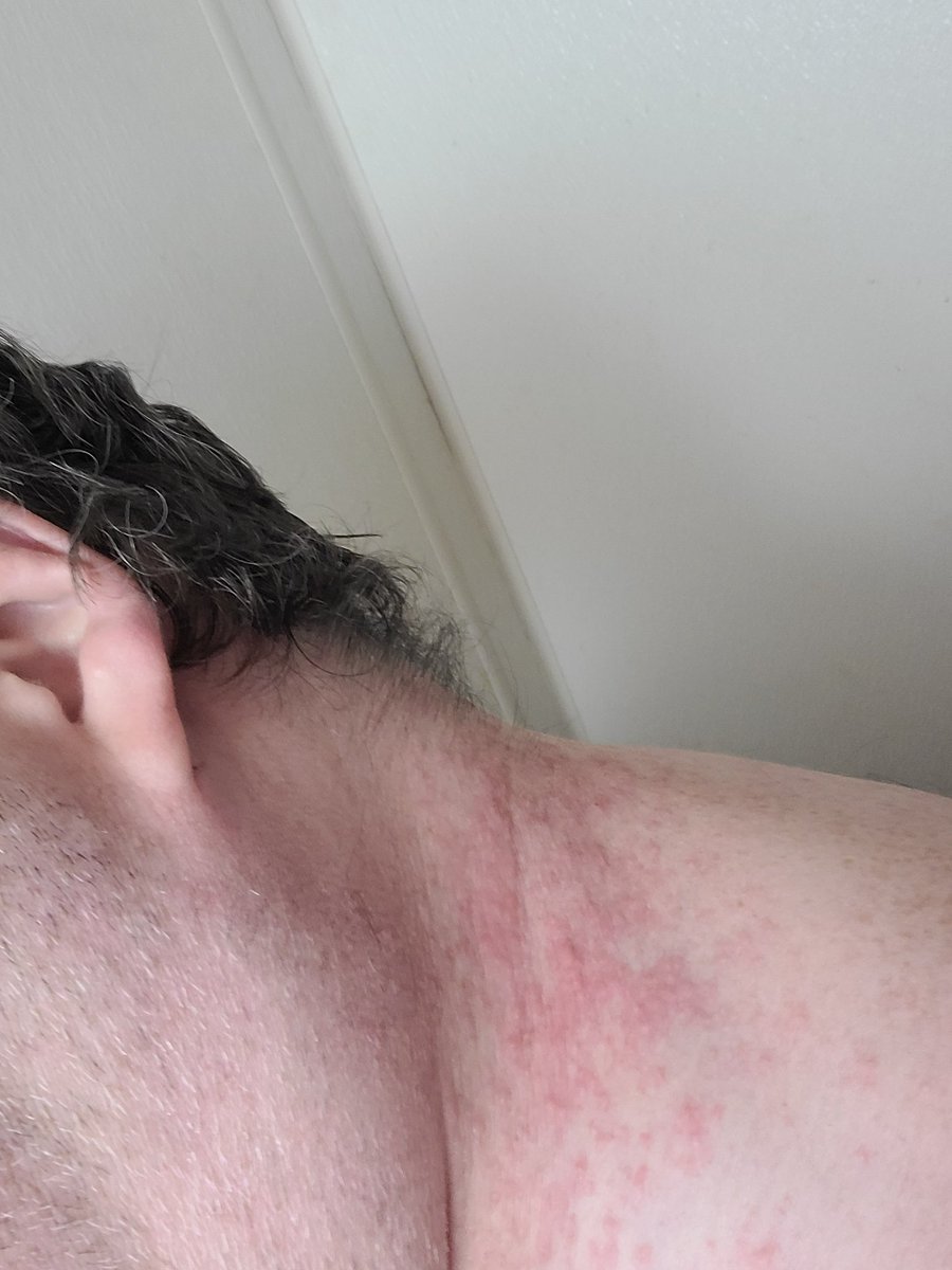 christian colbenson tweet media