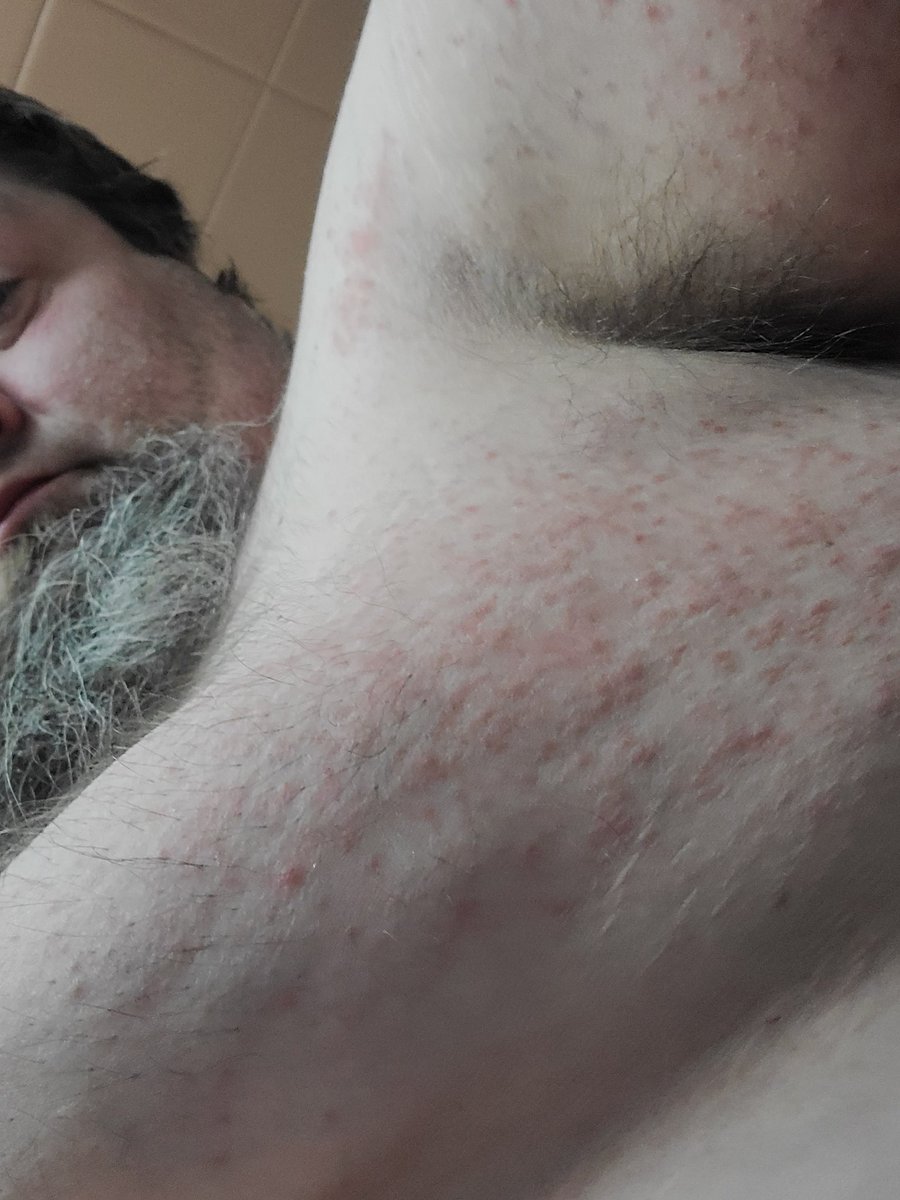 christian colbenson tweet media