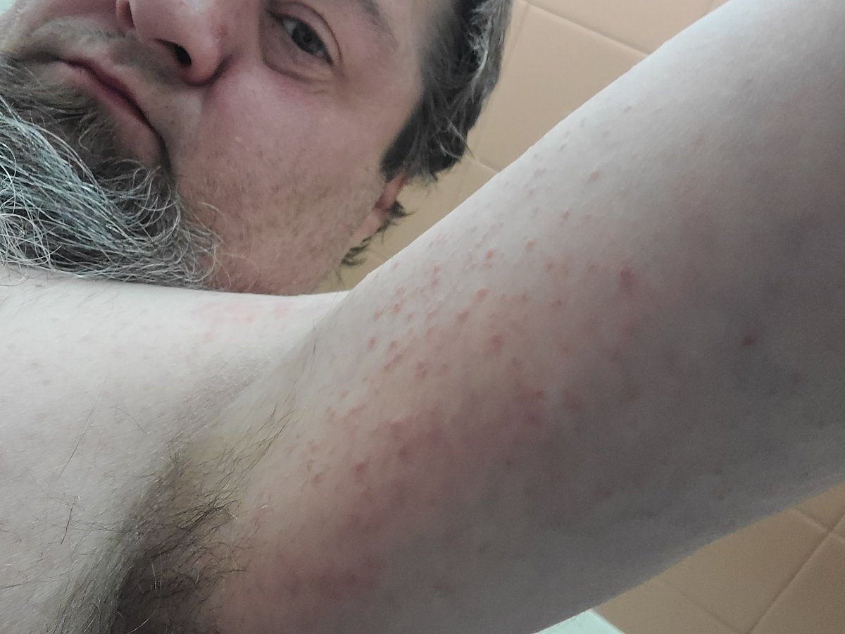 christian colbenson tweet media