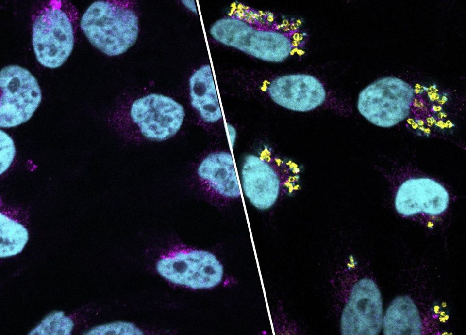 Doherty Institute (@thedohertyinst) on Twitter photo Researchers have discovered how Golden #staph hides inside human cells to avoid detection by immune system using their new state-of-the-art methodology called #InToxSa
Learn more about the research and new tool👉doherty.edu.au/news-events/ne…
<a href="/AbdouH/">Abdou Hachani</a> <a href="/tstinear/">Tim Stinear</a> <a href="/UniMelbMDHS/">UniMelb MDHS</a> <a href="/TheRMH/">The Royal Melbourne Hospital</a> Researchers have discovered how Golden #staph hides inside human cells to avoid detection by immune system using their new state-of-the-art methodology called #InToxSa
Learn more about the research and new tool👉doherty.edu.au/news-events/ne…
<a href="/AbdouH/">Abdou Hachani</a> <a href="/tstinear/">Tim Stinear</a> <a href="/UniMelbMDHS/">UniMelb MDHS</a> <a href="/TheRMH/">The Royal Melbourne Hospital</a>