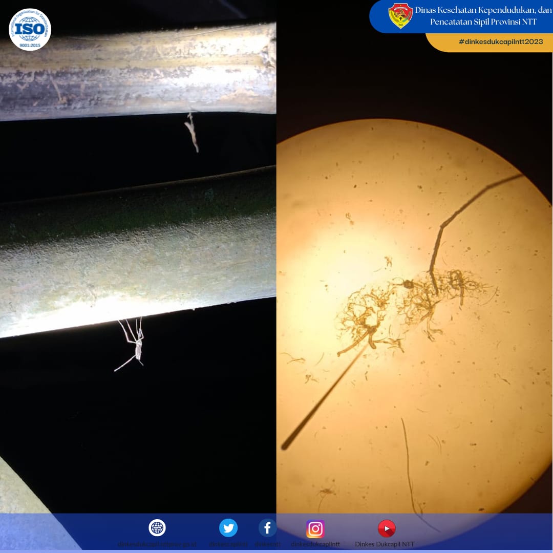 dinkesntt's tweet photo. 05 - 10 Juni 2023
Kegiatan Survei Longitudinal di laksanakan di kabupaten sumba barat di puskesmas Gaura pada desa Harona Kalla.
#dinkesdukcapilntt2023 #P2PM #malaria #SISMAL #surveilongitudinal https://t.co/oTVsSkFkB4