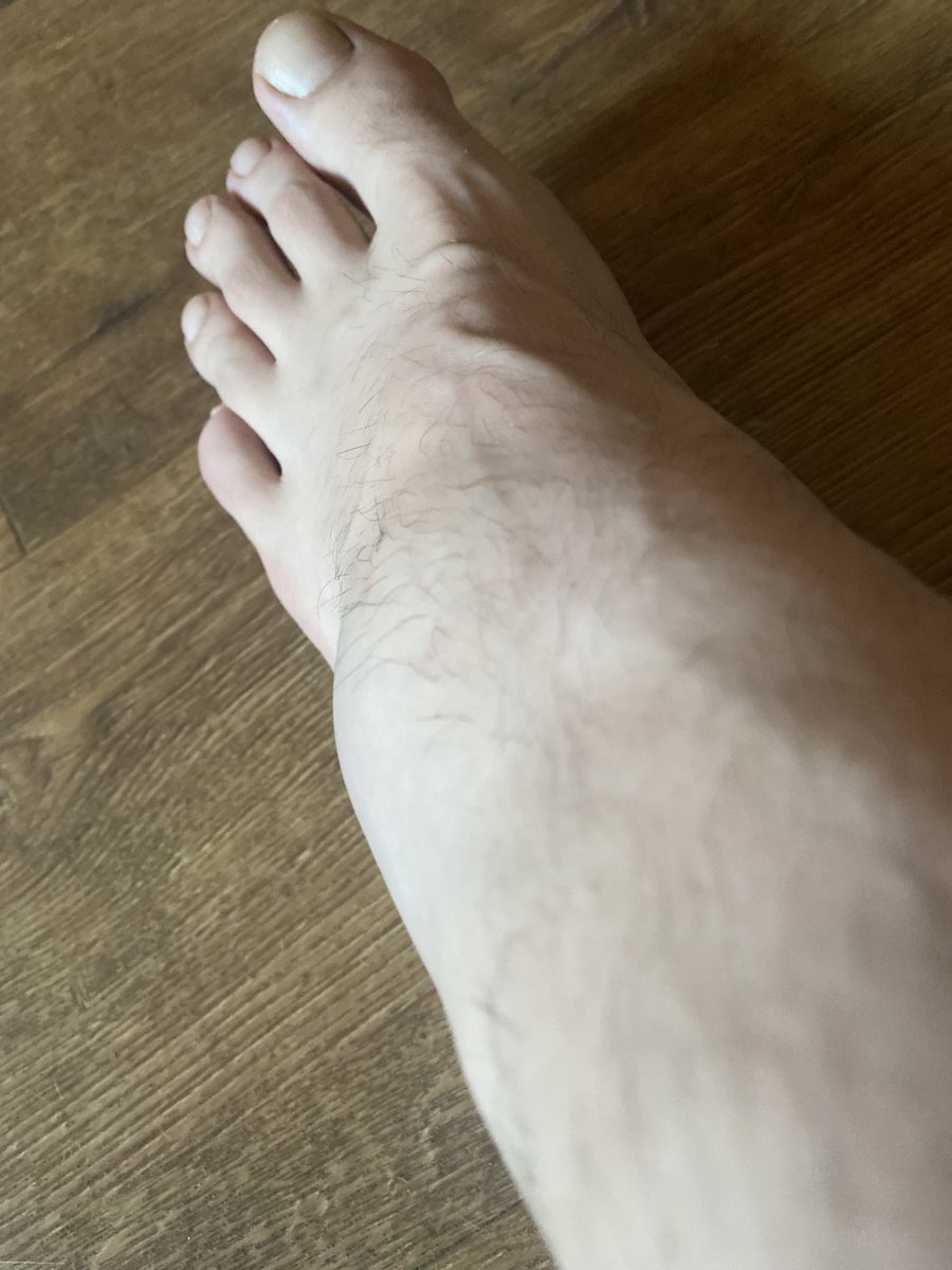 I have an elephant foot after I unbelievably fell down a rabbit hole yesterday whilst out walking the dog 🙈, if you were coming to see me at Oundle, Chiswick or Chester house I’ve had to cancel, I’ll hopefully be back soon, I definitely did something wrong previous life.