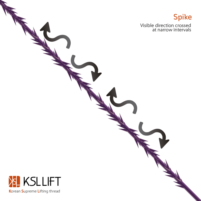 JeongSo44394036's tweet image. Cog cut at an optimal angle.
-Various designs such as 360 degree, bidirectional, pattern.
.
.
#ksl #ksllift #liftingthreads #supreme #supremelift #placl #pdo #pdothreads #pcl #pclthreads #moldingthread #monothreads #screwthread #cogthread
#nosethreadlift #duallifting