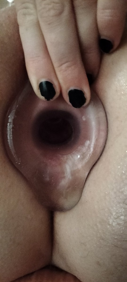 MandMunleashed's tweet photo. Big tunnel plug stretching her hole
#buttplug  #asshole https://t.co/FJ57alh8Wm