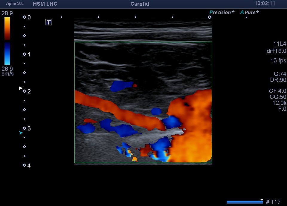 Neurosonology Lab - LHC tweet media