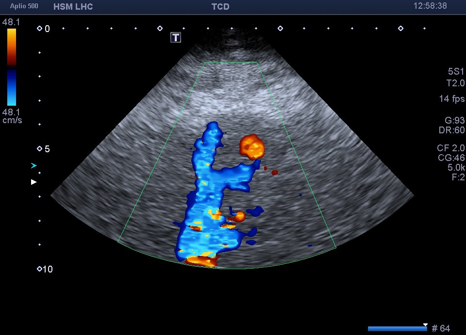 Neurosonology Lab - LHC tweet media