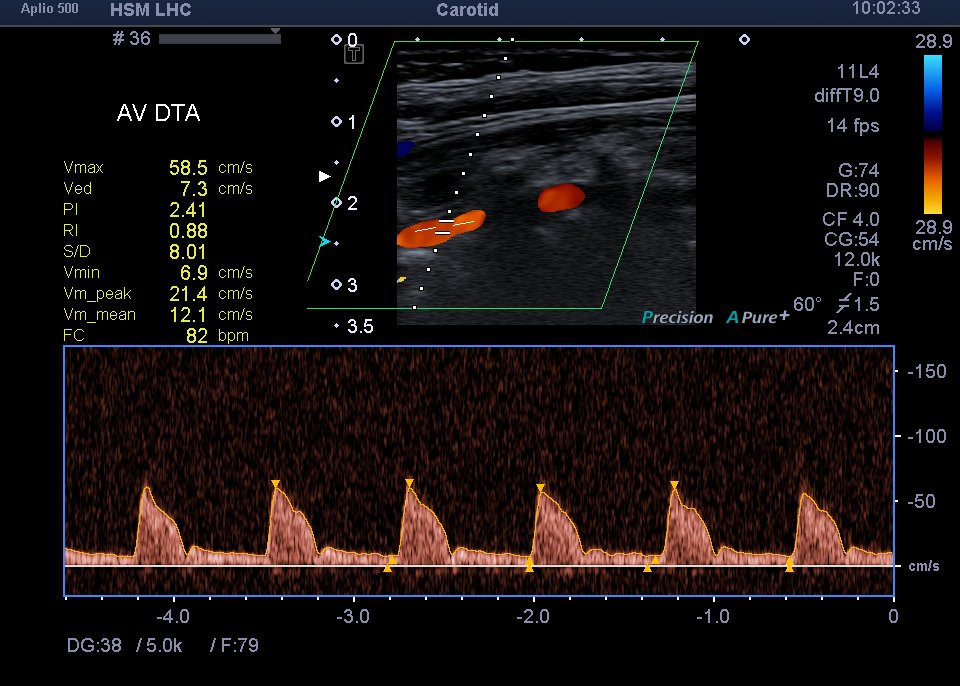 Neurosonology Lab - LHC tweet media
