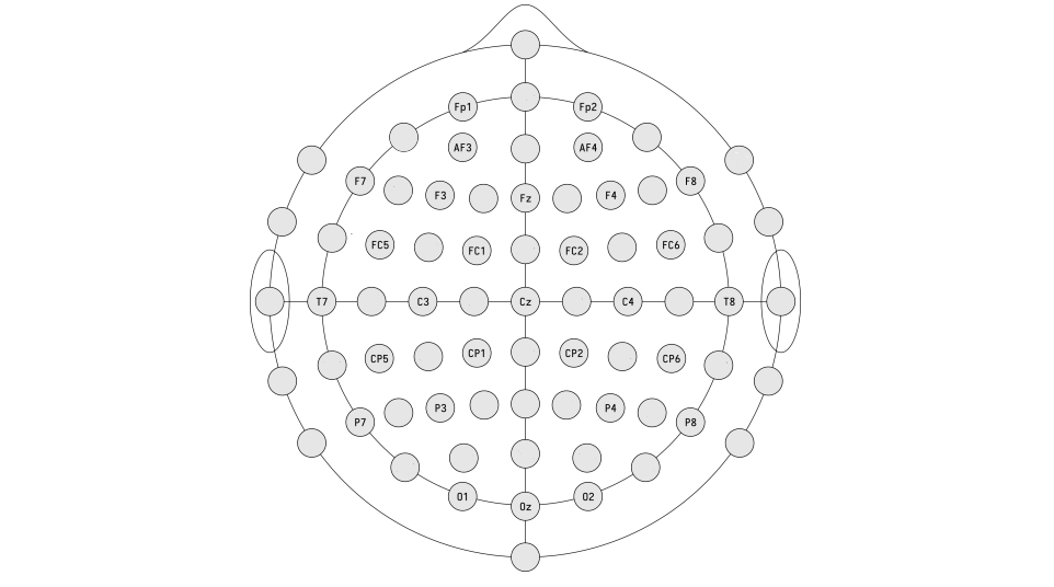 BMDLabUiS's tweet photo. We are delighted to announce that our paper has been accepted at EUSIPCO 2023.

"Assessing gender fairness in EEG-based machine learning detection of Parkinson's disease: A multi-center study" by Anna Kurbatskaya
Link to paper: https://t.co/kKHtAZGtUd https://t.co/Vyro0nzb1t