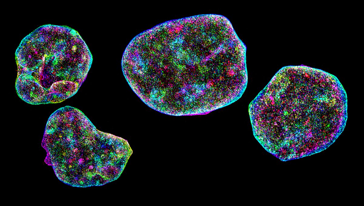 DNA in the nuclei of three cells photographed through a microscope. #CellBiology