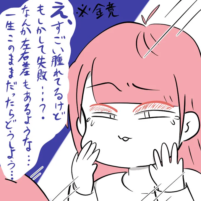 整形初心者あるある②
整形直後には綺麗になっていると思っていたので、想像以上に腫れていて失敗だと思うパターン。
これは二重埋没法の例😅⬇️
#整形漫画 #整形垢さんと繋がりたい
#美容垢さんと繋がりたい 